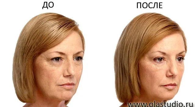 Моделирование лица объемное